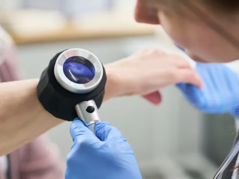 Skin Cancer Screenings