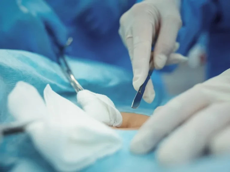 Surgical Dermatology
